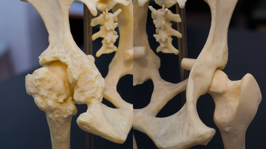 Hip Dysplasia in Dogs: What Should Every Owner Know?
